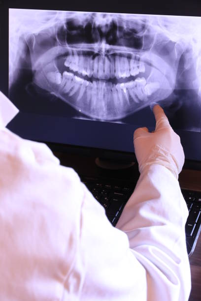 Best Emergency Denture Repair in Chico, WA